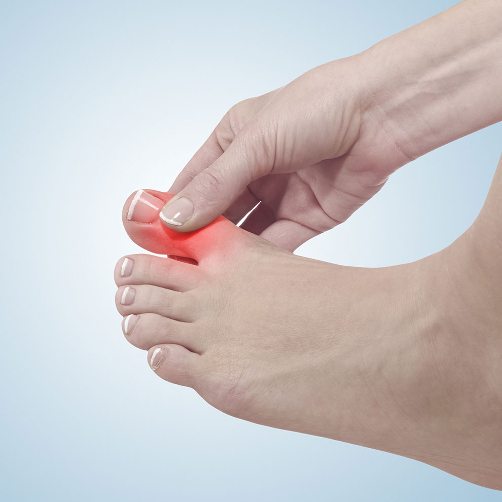 Harnsäure ist ein Indikator von Gicht. Der Test erfolgt in unsere Apotheke in Schaffhausen.