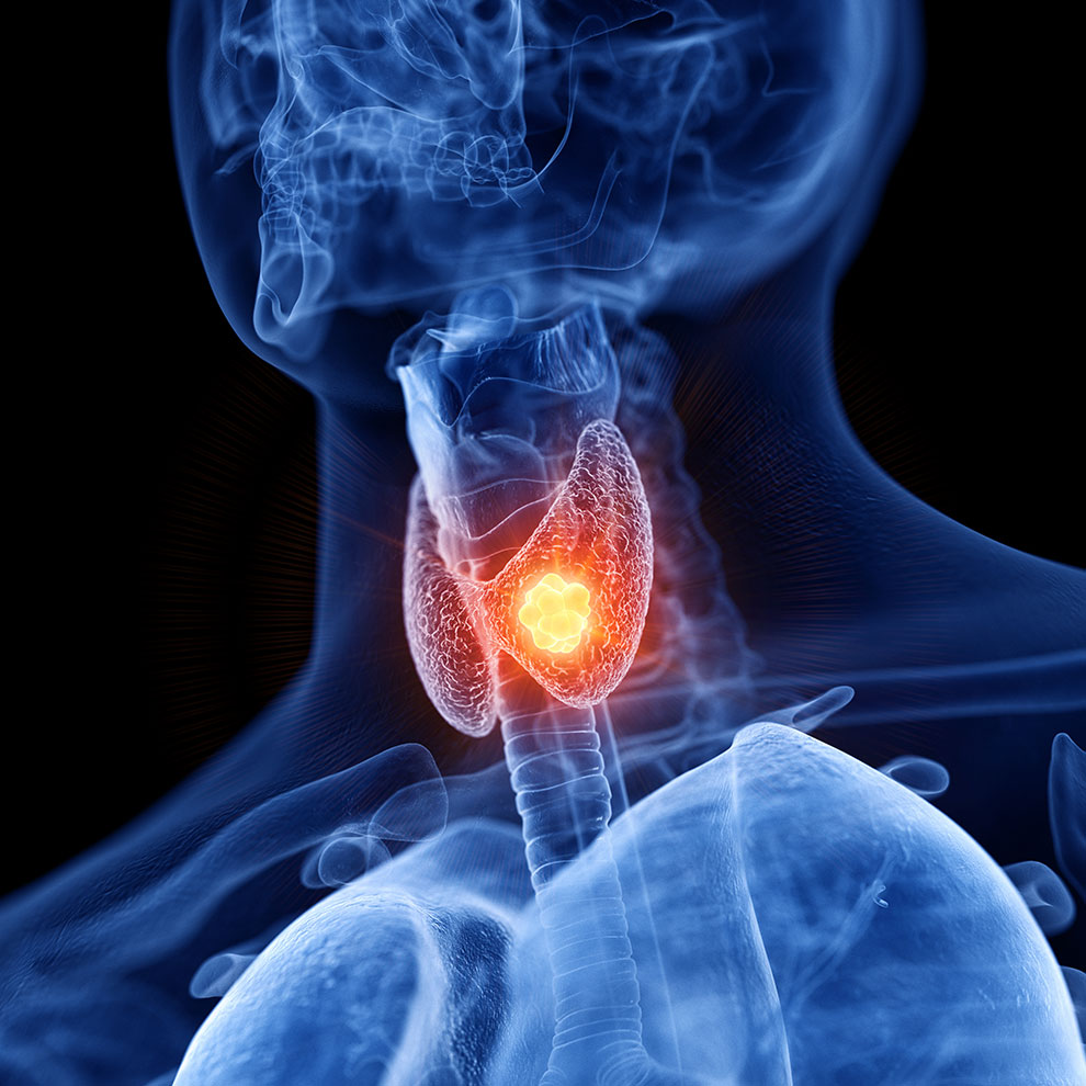 Lassen Sie in unserer Apotheke die Hormone in Ihrer Schilddrüse testen.