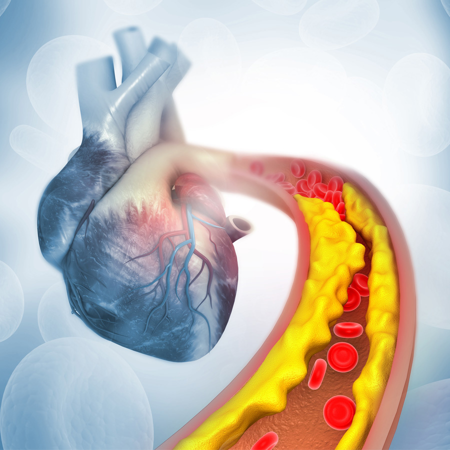 Wir überprüfen Ihre Cholesterinwerte schnell und unkompliziert in unserer Apotheke in Schaffhausen.